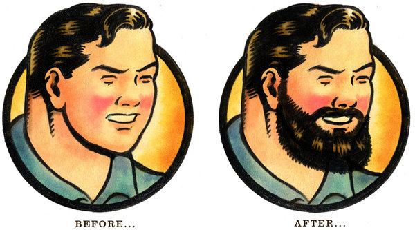 How Much Does Beard Transplant Cost?