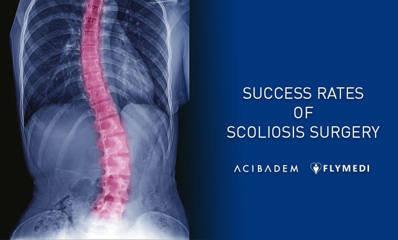 Cover image for Success Rates of Scoliosis Surgery