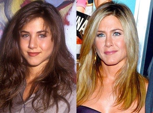 5 Celebrities Who Had a Nose Job
