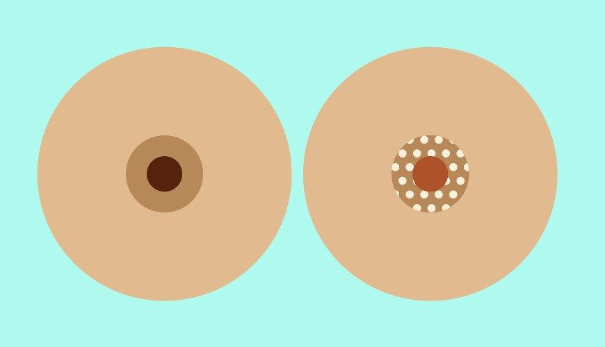 Cover image for How Much Does Breast Cancer Treatment Cost ? World Prices