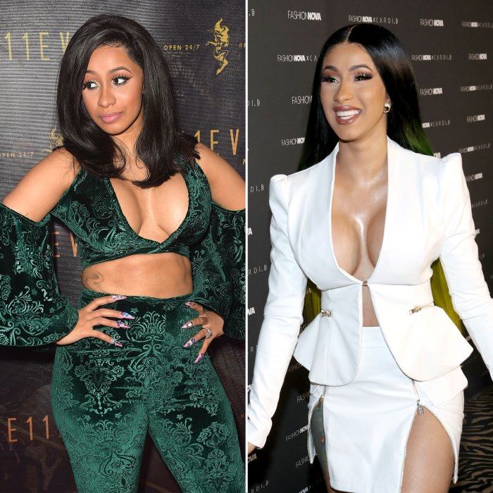 8 Female Celebrities Who Have Had Plastic Surgery