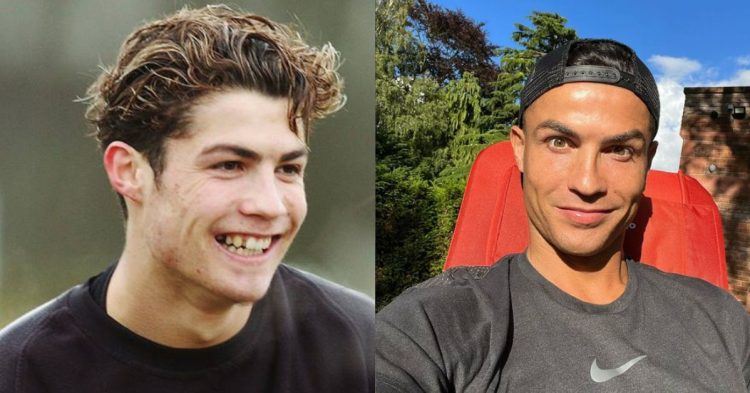Las cirugías que transformaron a Cristiano Ronaldo