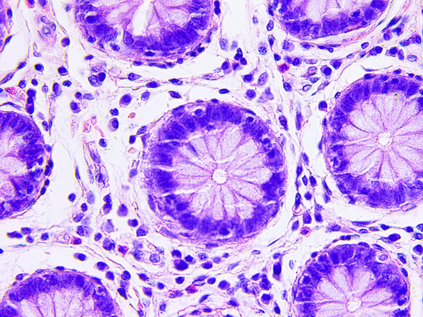 Things You Should Know about Cancer