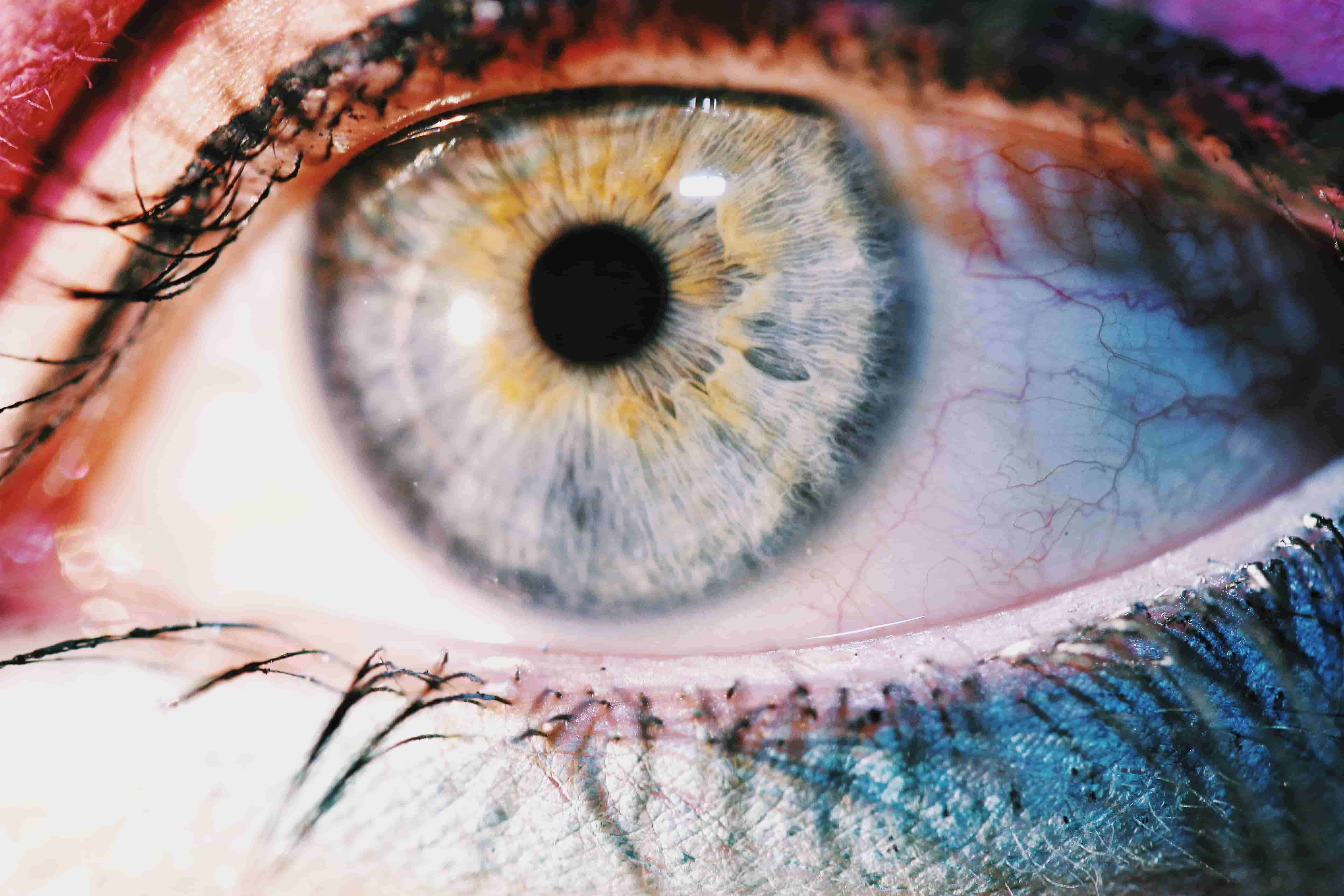 Lasik Eye Surgery: Is This the Best Option?