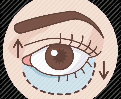 Cover image for Eyelid Surgery – Top 7 Things You Should Know