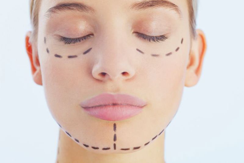 How To Prepare For A Facelift Procedure