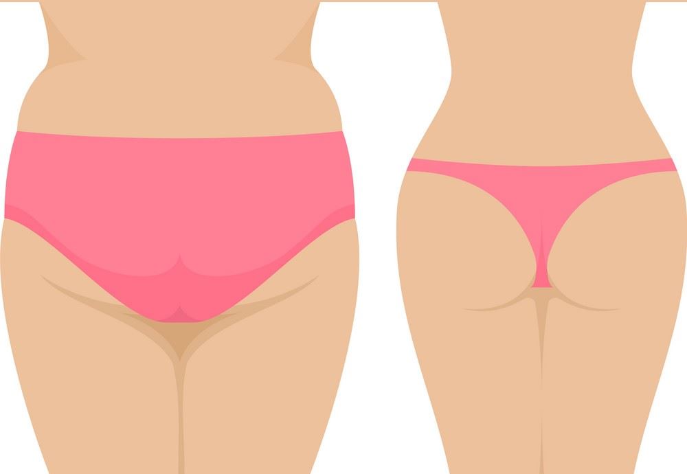 3 Ways to Maintain Your Post Liposuction Surgery Results