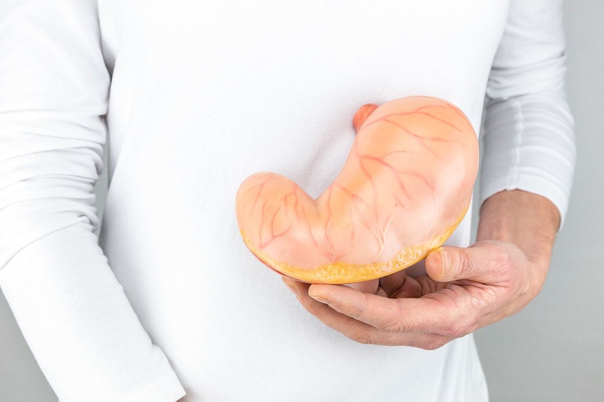 Cover image for Gastric Bypass Surgery – Common Questions