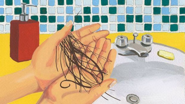 Hair Transplant Procedure Common Questions