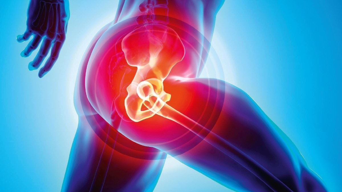 Hip Replacement Surgery - 5 Facts You Need to Know