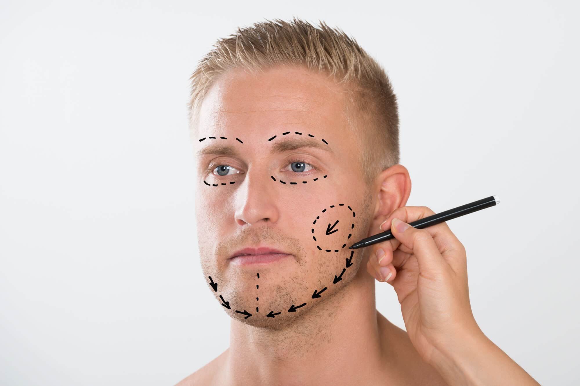 Cover image for Attractive Choices of Plastic Surgery for Men
