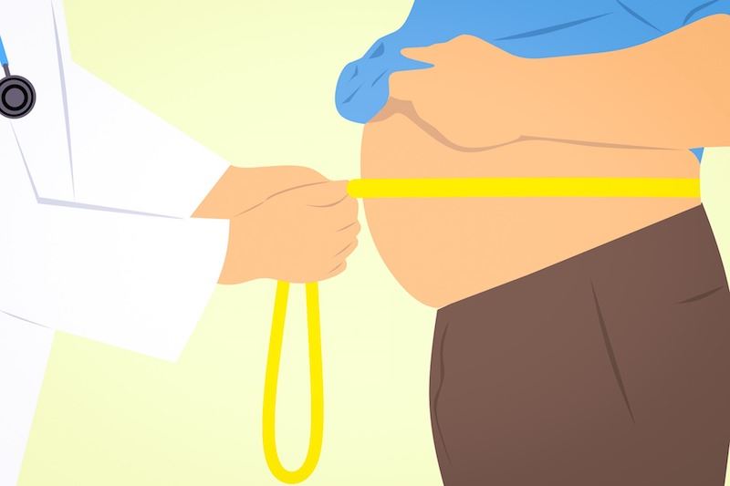 6 Things You Should Know About Gastric Sleeve Surgery