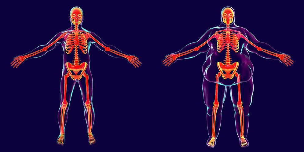 Does Being Overweight Increase Cancer Risk?