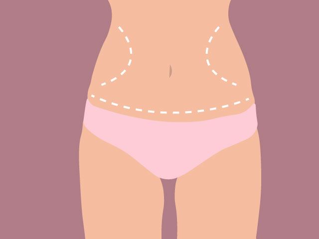 Cover image for What You Should Know Before and After Tummy Tuck Surgery ?