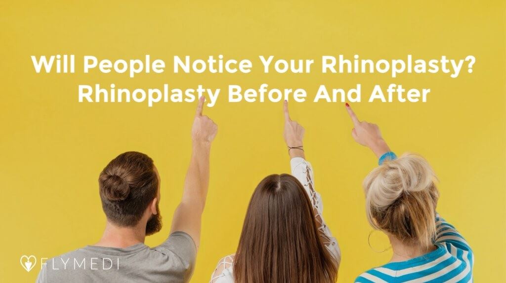Cover image for Will People Notice Your Rhinoplasty? Rhinoplasty Before And After