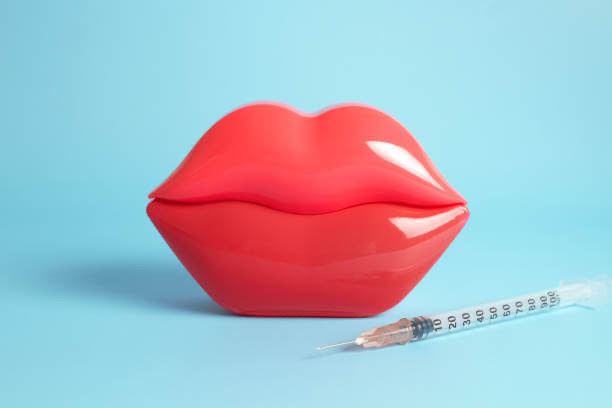 Russian Lips or Classic Fillers: Which Reigns Supreme?