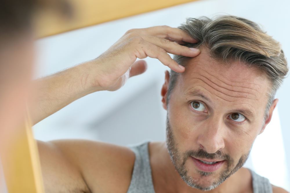 How to Prepare for a Hair Transplant in Turkey
