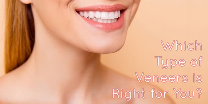 Which Types of Veneers is Right for You?