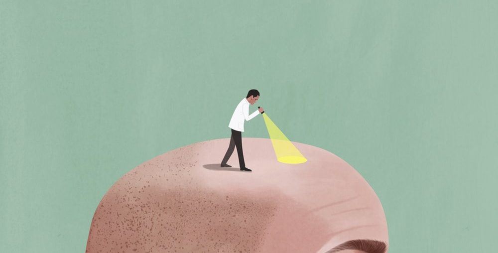Hair Transplant: How To Choose The Right Clinic?
