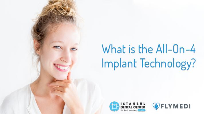 Cover image for What is the All-On-4 Implant Technology?