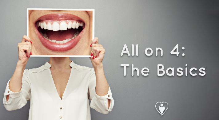 All on 4 – The Basics