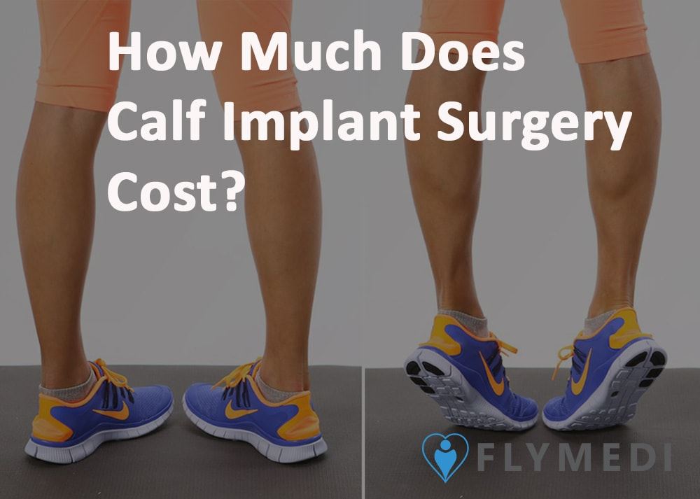 Cover image for Calf Implants Cost – The Prices Will Surprise You