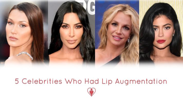 5 Celebrities Who Had Lip Augmentation