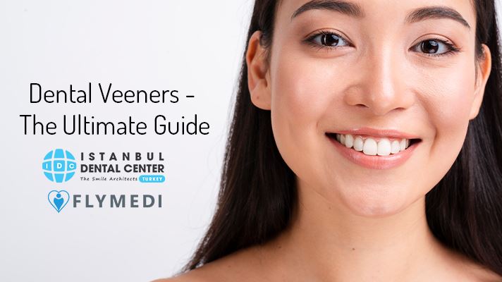 Dental Veneers - The Ultimate Guide