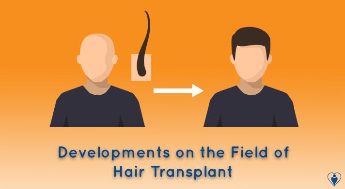 Developments On The Field Of Hair Transplant | Latest Technology