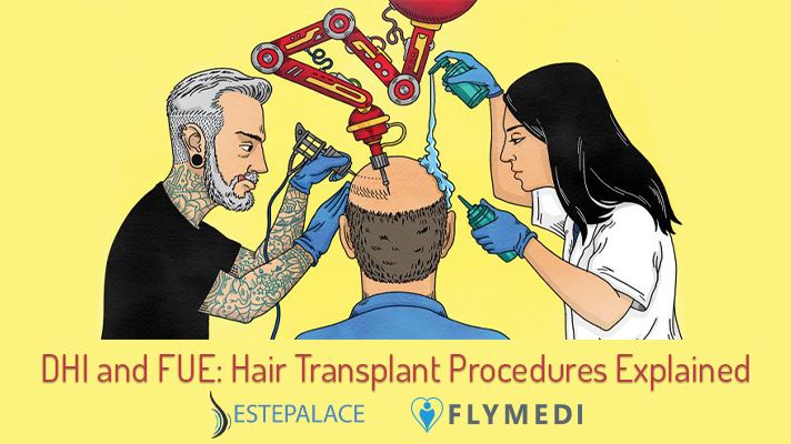 DHI and FUE: Hair Transplant Procedures Explained