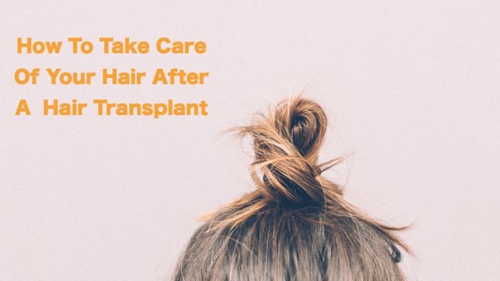 What To Do After a Hair Transplant