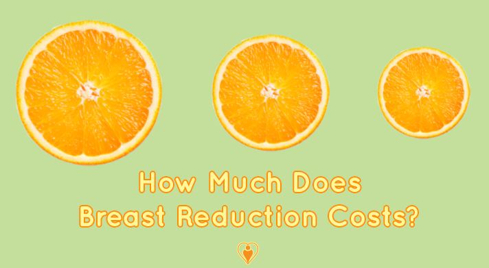 Cover image for How Much Does Breast Reduction Cost?