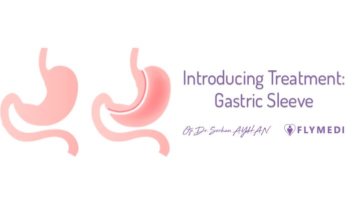 Cover image for Introducing Treatment: Gastric Sleeve