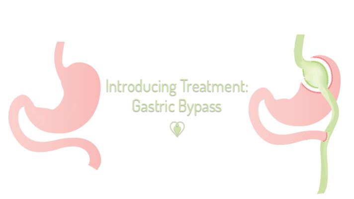 Cover image for Introducing Treatment: Gastric Bypass