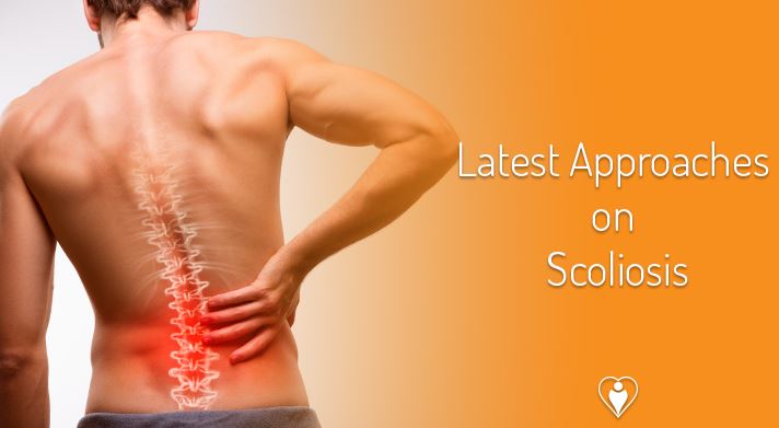 Cover image for Latest Approaches on Scoliosis