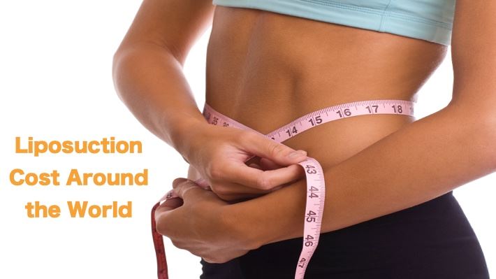 Cover image for What is the Cost of Liposuction Around the World?