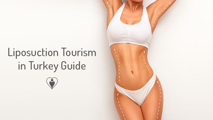 Cover image for Liposuction Tourism in Turkey Guide