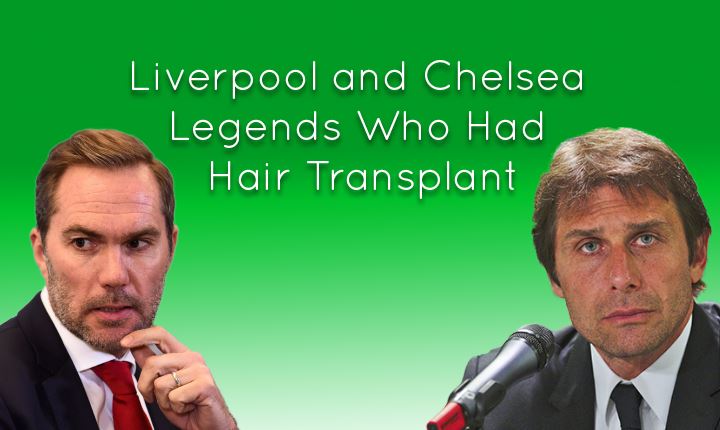 Liverpool and Chelsea Legends Who Had Hair Transplant