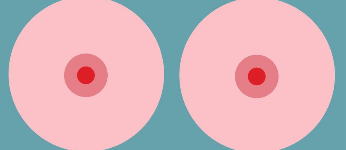 Cover image for Breast Lift - 6 Things You Should Know About
