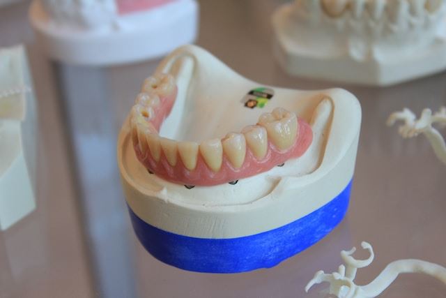 Best Place for All-on-4 Dental Implants: Discover Turkey!