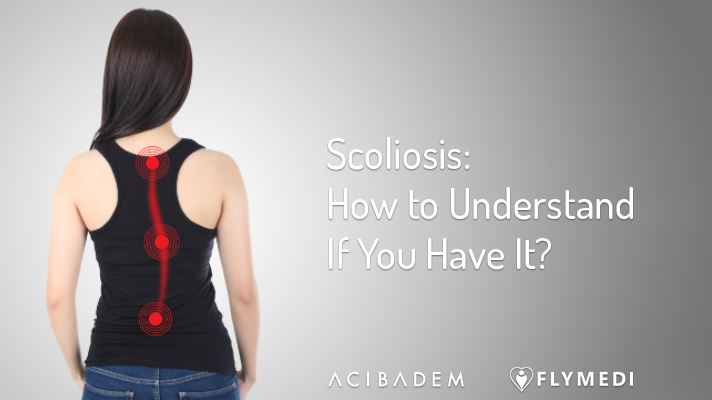 Scoliosis: How to Understand If You Have It?