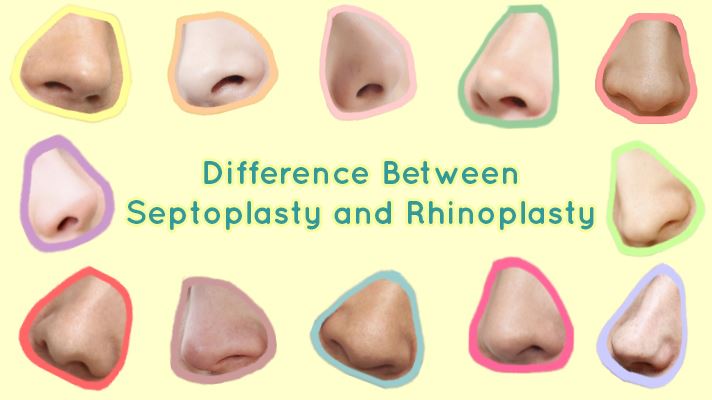 Cover image for Difference Between Septoplasty and Rhinoplasty