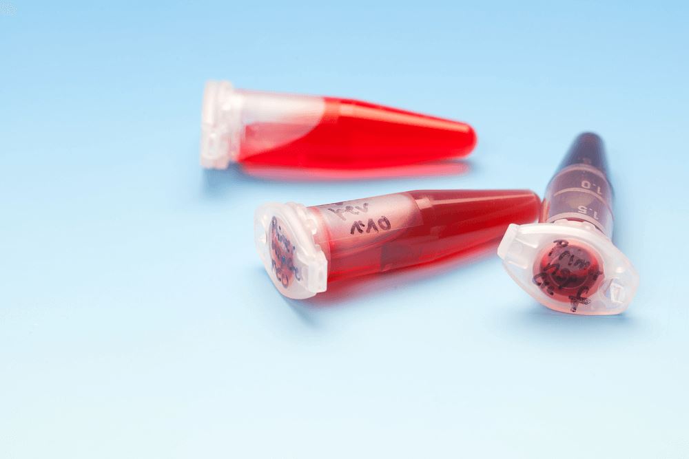 What Do You Know about Stem Cell Therapy?
