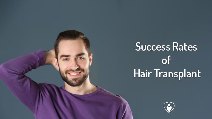 Success Rates of Hair Transplant | Best Success for Hair Transplant is in Turkey