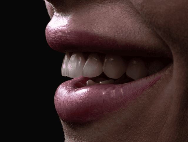 Titelbild für Symptoms of Loose Dental Implant Crown: Failing Implant?