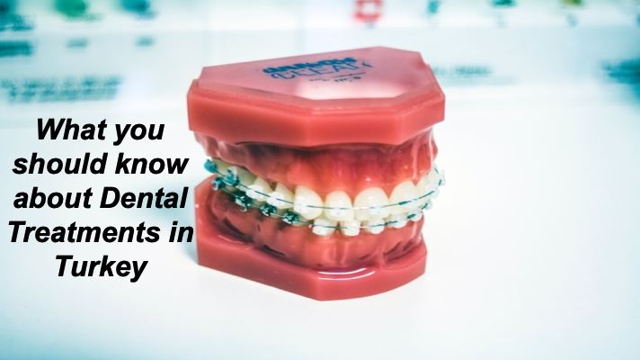 Cover image for Dental Treatment In Turkey: All Questions Answered