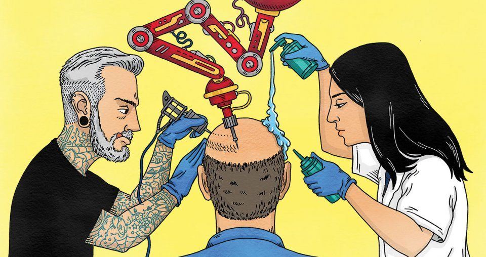 Hair Loss Treatment | Best Way to Cure Hair Loss