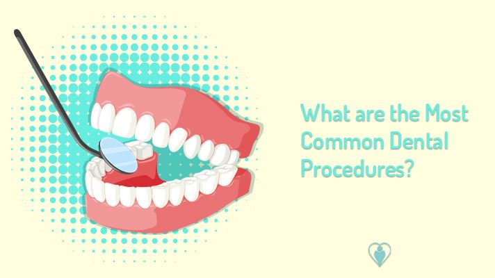 What are the Most Common Dental Procedures?