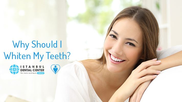 Why Should I Whiten My Teeth?