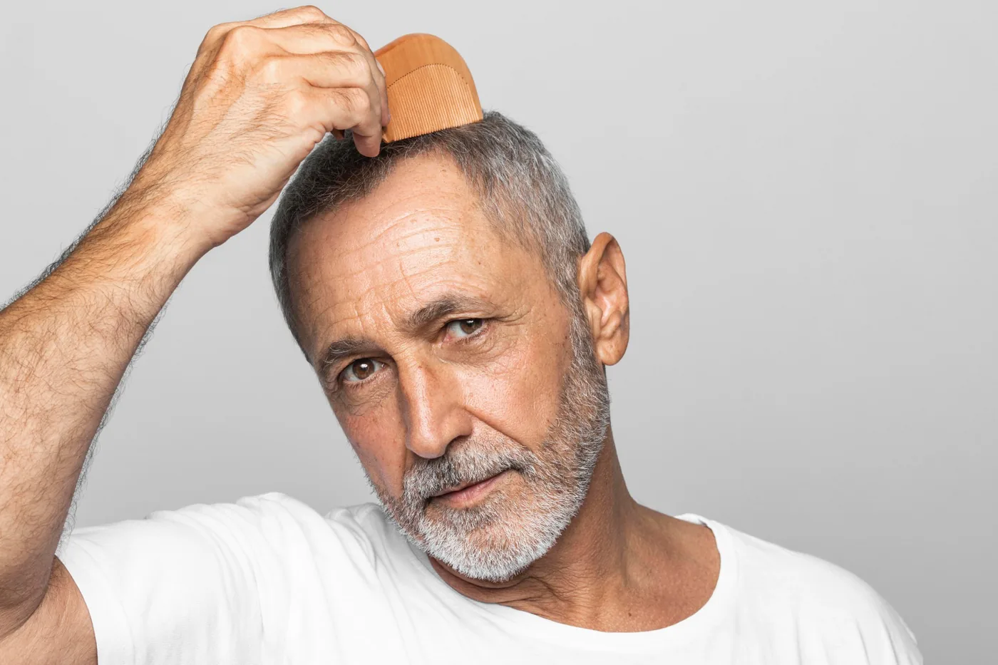 Cover image for Hair transplant after 20 years: what lasts, what changes and what can be fixed